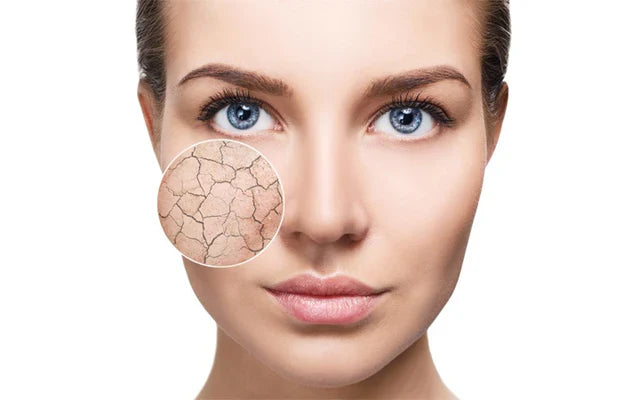 Dry Skin