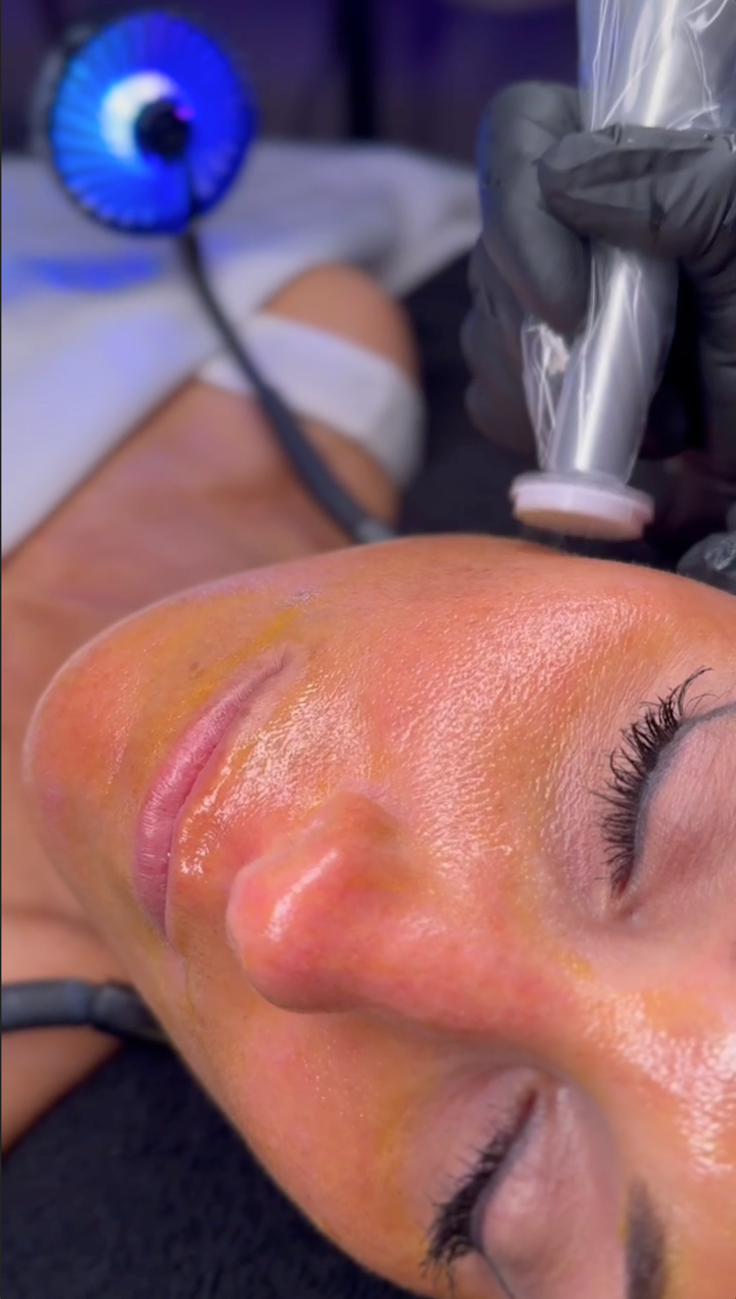 BioRe Peel + Facial